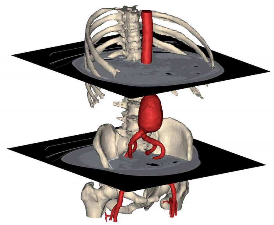 Maggiori informazioni su "Stampa 3D: nuove opportunità per la medicina"